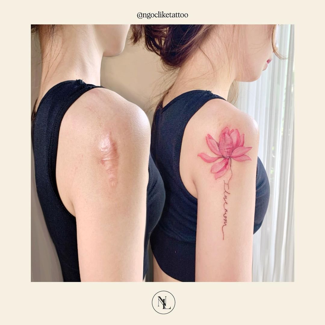 Tatuajes Creativos Que Cubren Cicatrices